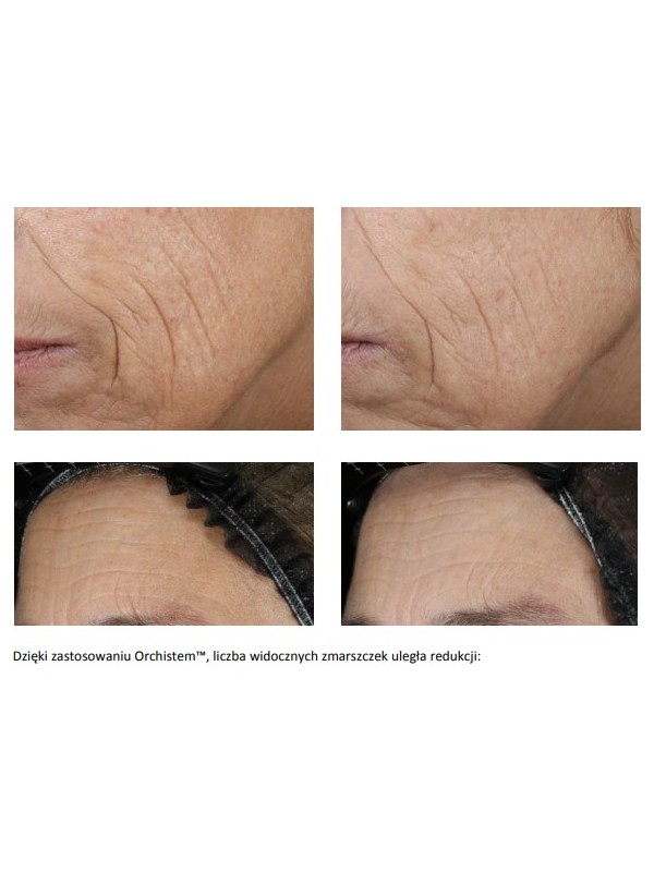 Set - Face Serum - Two packs