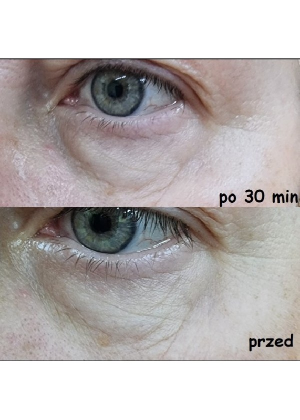 Set - Face Serum - Two packs