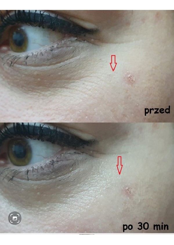 Set - Face Serum - Two packs
