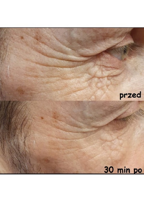 Set - Face Serum - Two packs