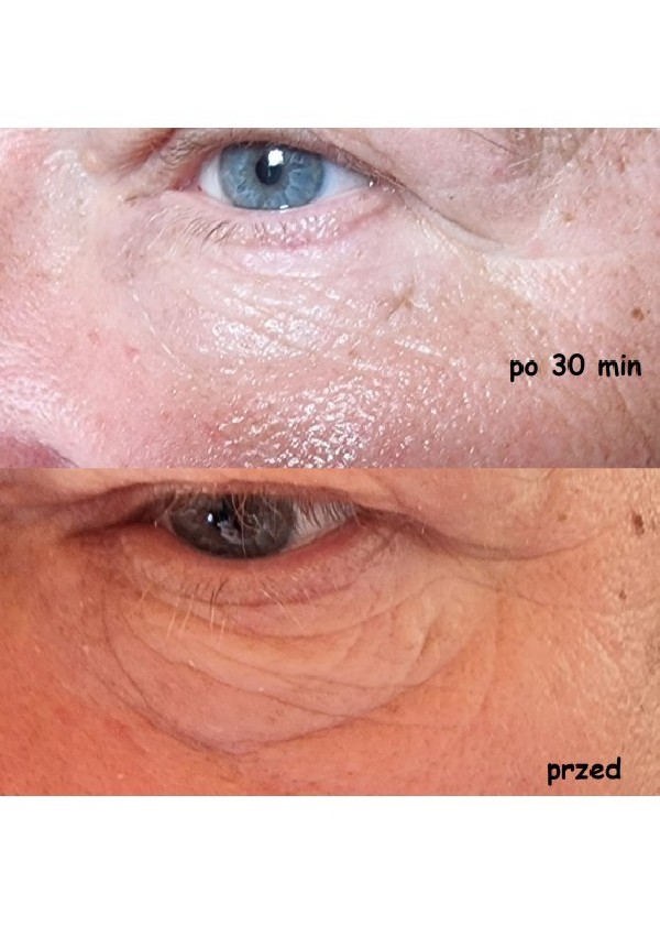 Set - Face Serum - Two packs