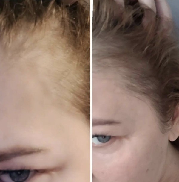 Hair serum - Hair growth product