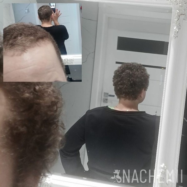 Hair serum - Hair growth product