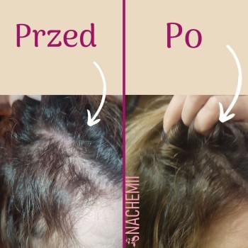 Hair serum - Strengthened, thick and healthy hair - Online Shop Poland