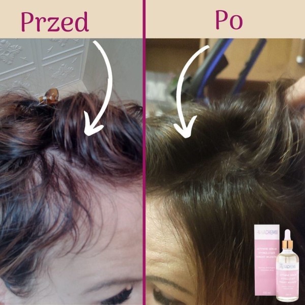 Hair serum - Strengthened, thick and healthy hair - Online Shop Poland