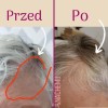 Serum stymulujące porost włosów