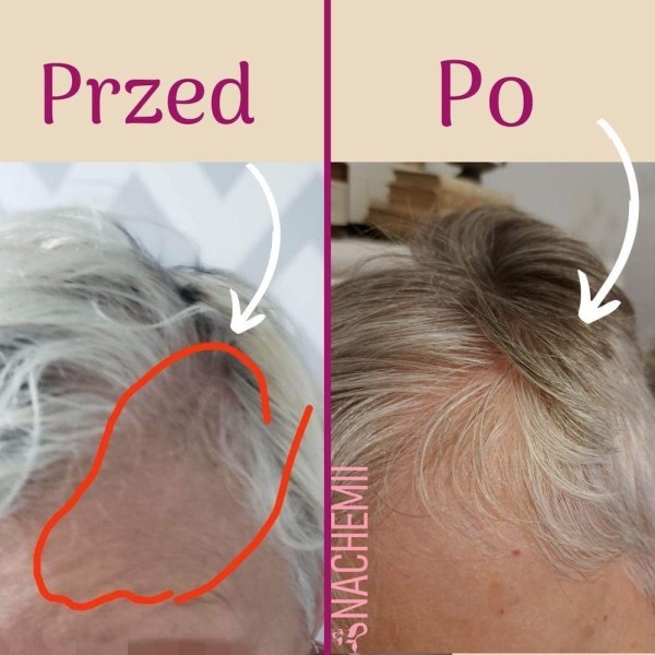 Hair serum - Hair growth product