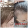 Serum stymulujące porost włosów