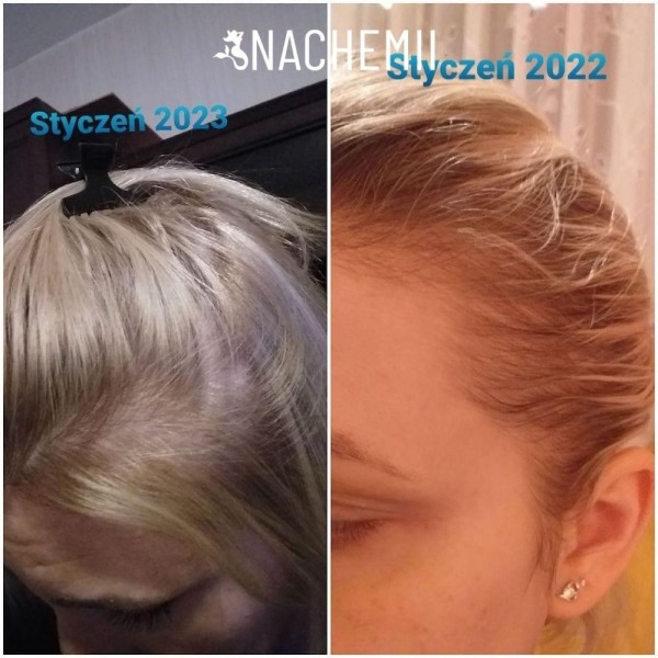 Hair serum - Hair growth product