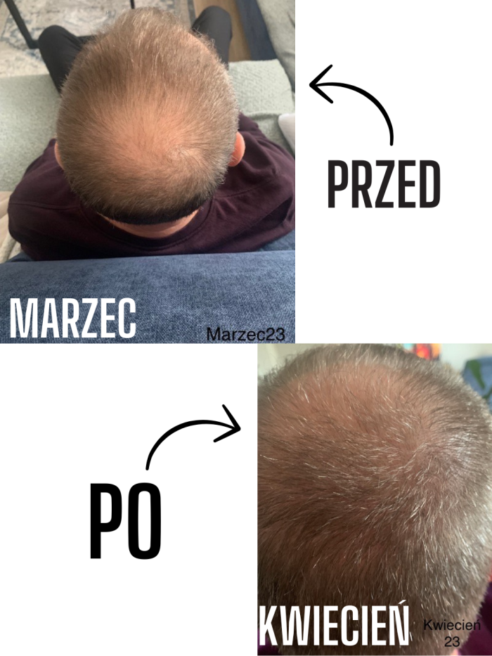 Haarwuchsserum - für Männer - Online-Shop