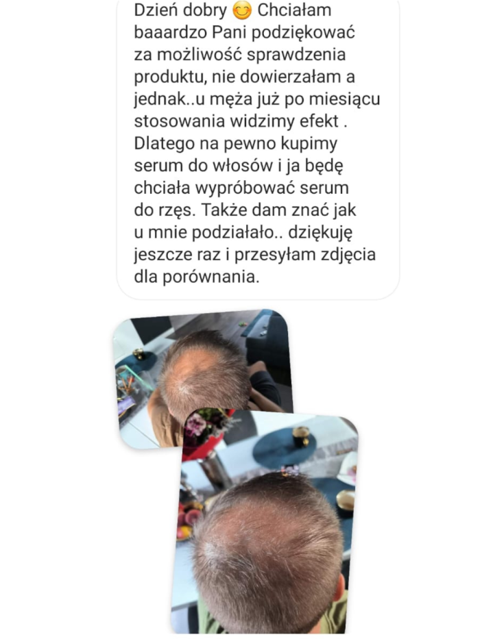 Haarwuchsserum - für Männer - Online-Shop