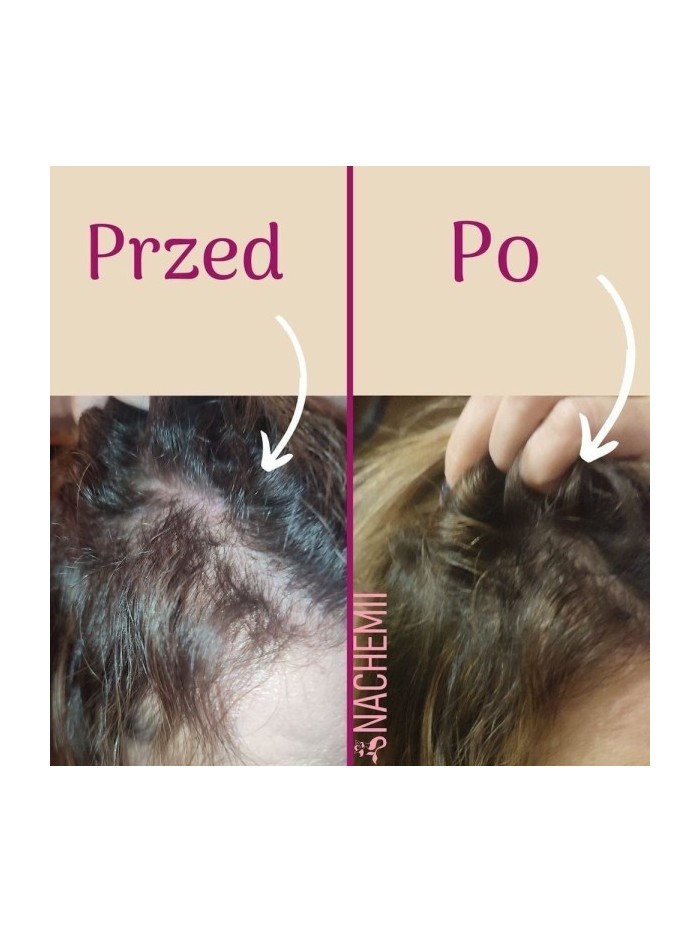 Full Treatment Serum Set - Online Store