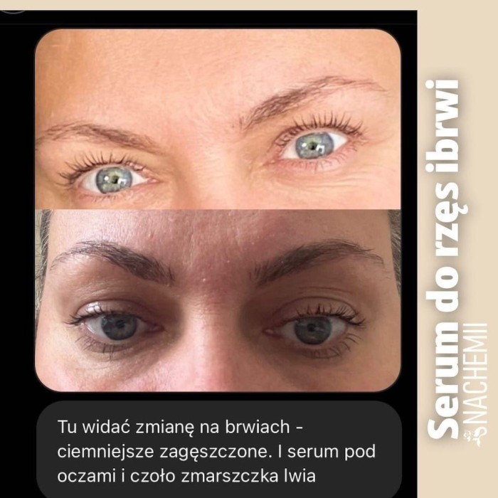 Serum for eyelash and eyebrow growth - Online Shop Poland