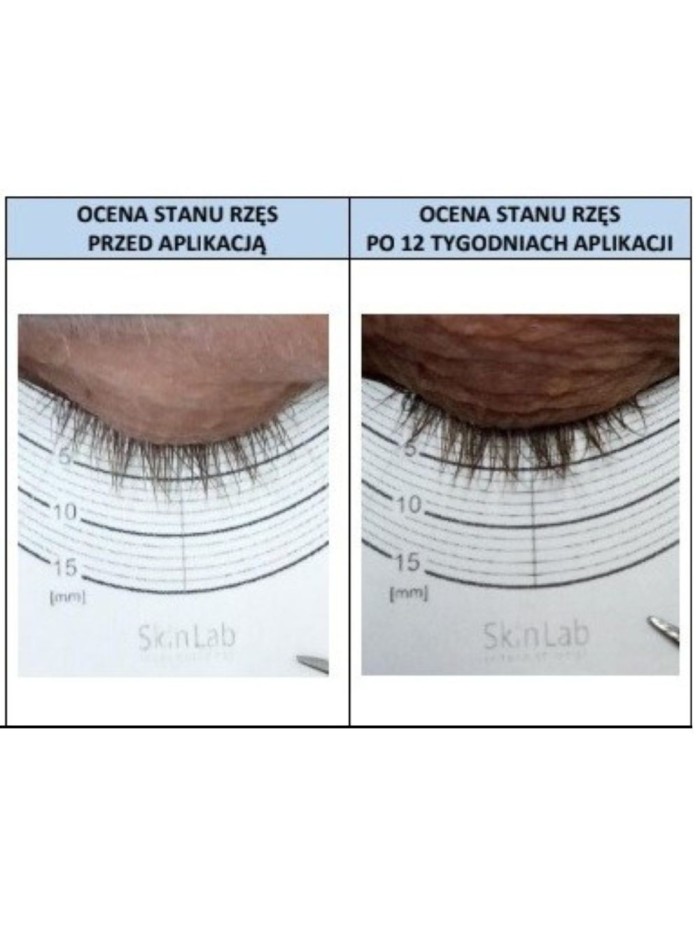 Serum for eyelash and eyebrow growth - Online Shop Poland