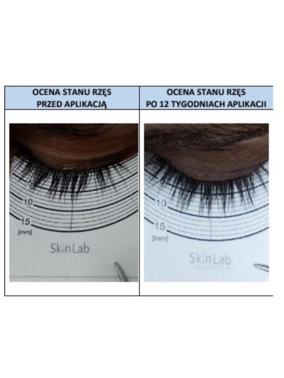 Serum for eyelash and eyebrow growth - Online Shop Poland