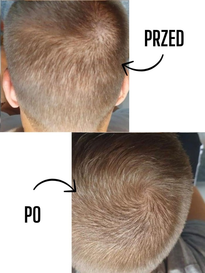 Haarwuchsserum - für Männer - Online-Shop