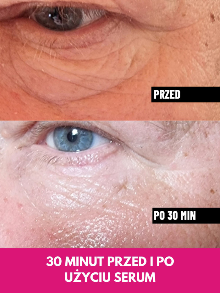 Face Serum - Lifts facial contours, reduces wrinkles