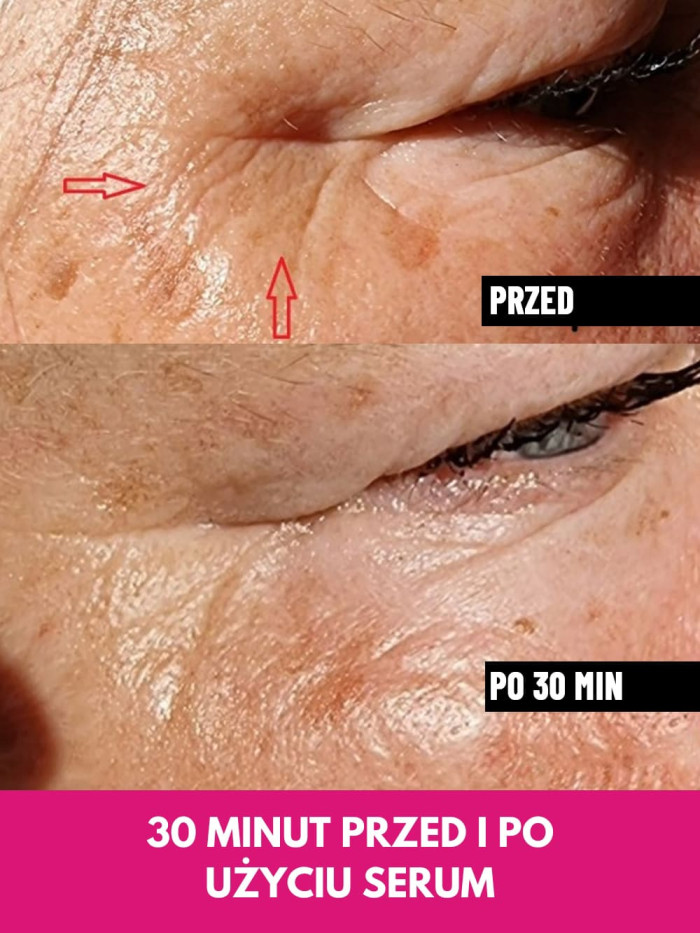 Face Serum - Lifts facial contours, reduces wrinkles