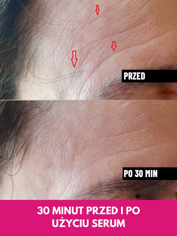 Face Serum - Lifts facial contours, reduces wrinkles