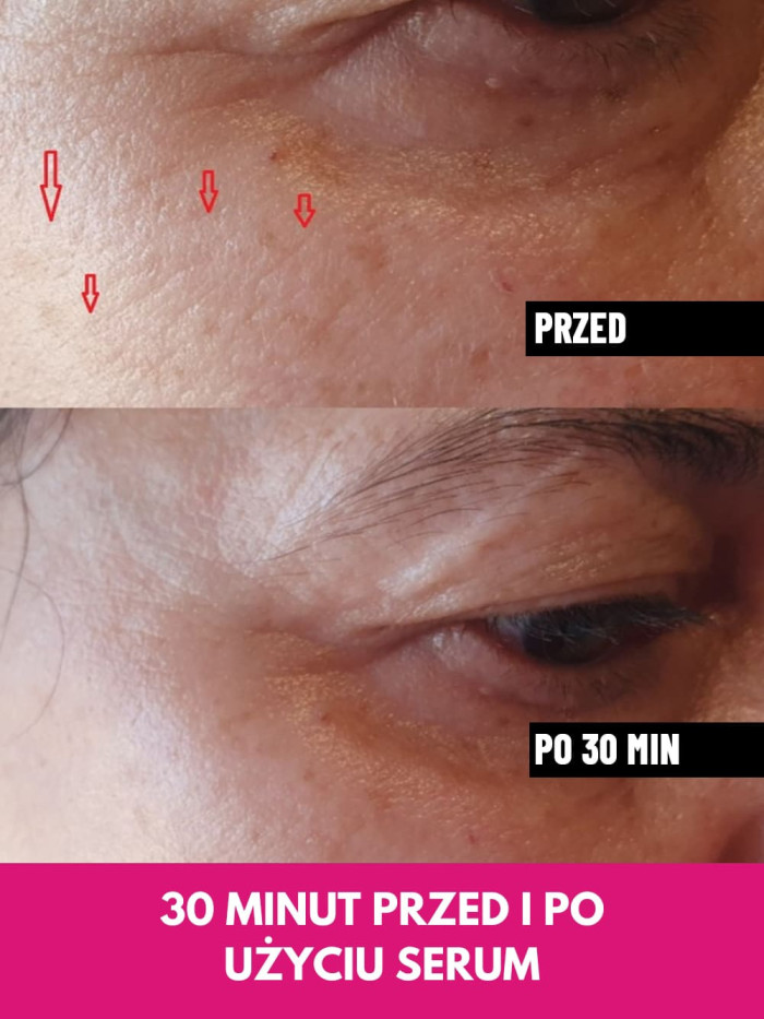 Face Serum - Lifts facial contours, reduces wrinkles