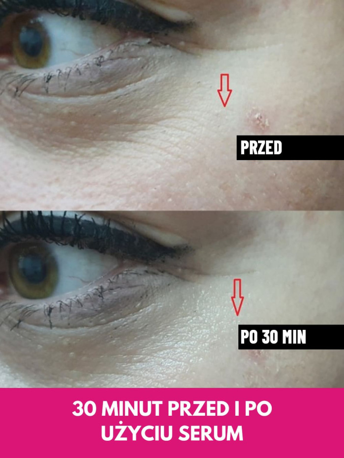 Face Serum - Lifts facial contours, reduces wrinkles