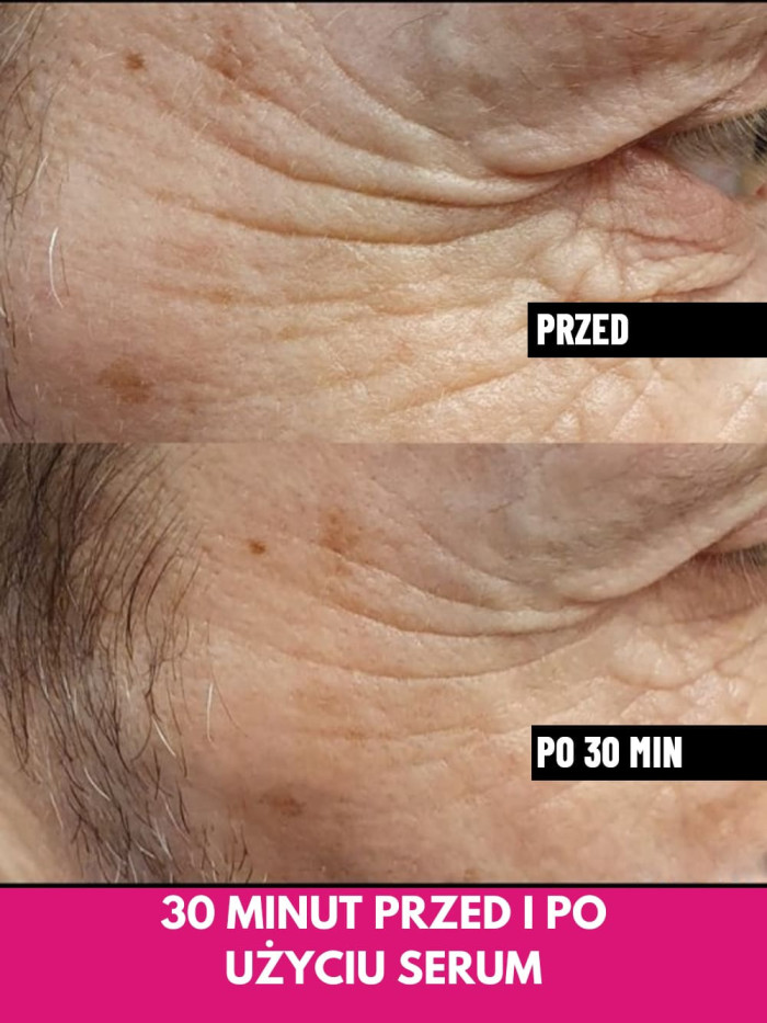 Face Serum - Lifts facial contours, reduces wrinkles