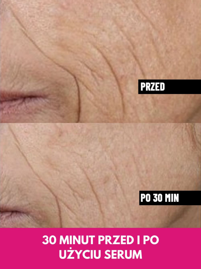Face Serum - Lifts facial contours, reduces wrinkles