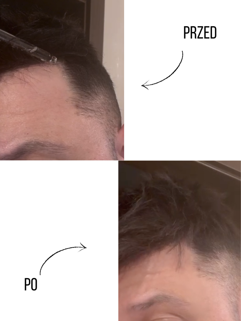 Hair growth serum - for men - online store