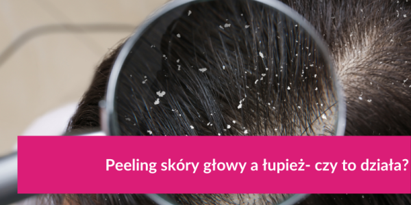 Peeling skóry głowy a łupież- czy to działa?