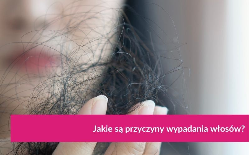 Jakie są przyczyny wypadania włosów?