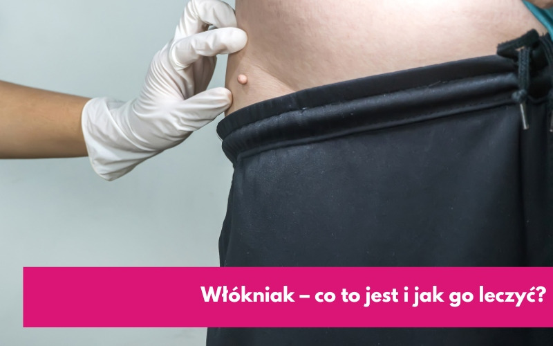 Włókniak - co to jest i jak go leczyć?