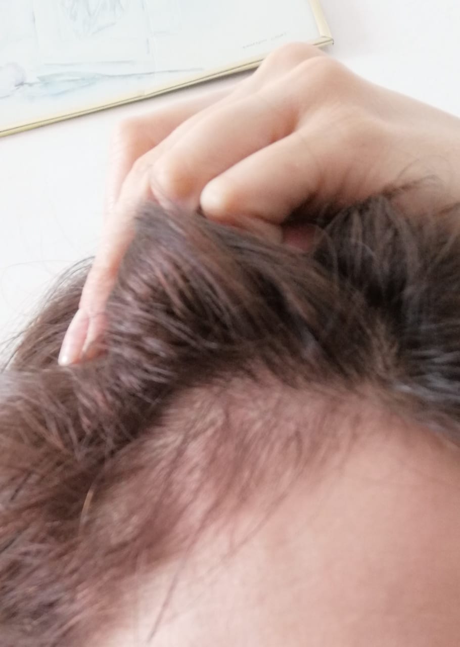 efekty stosowania serum na porost włosów
