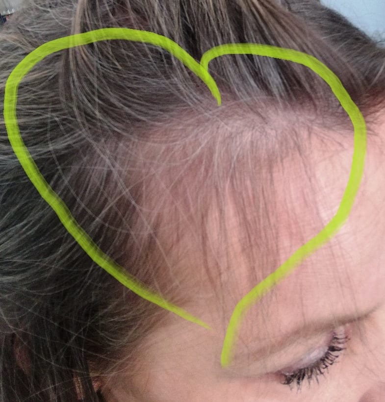 efekty stosowania serum na porost włosów